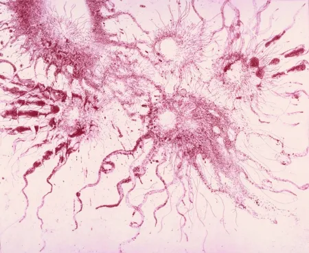 Aguafuerte Y Aguatinta Barcelo - Lanzarote 20