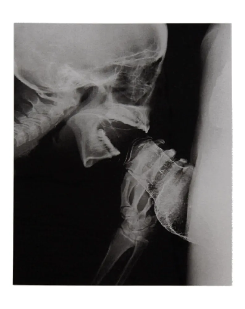 Libro Ilustrado Delvoye - Sexrays