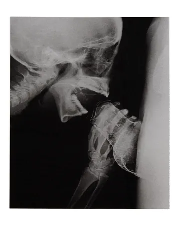 Libro Ilustrado Delvoye - Sexrays