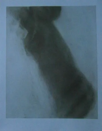 Aguafuerte Garache - Bleue