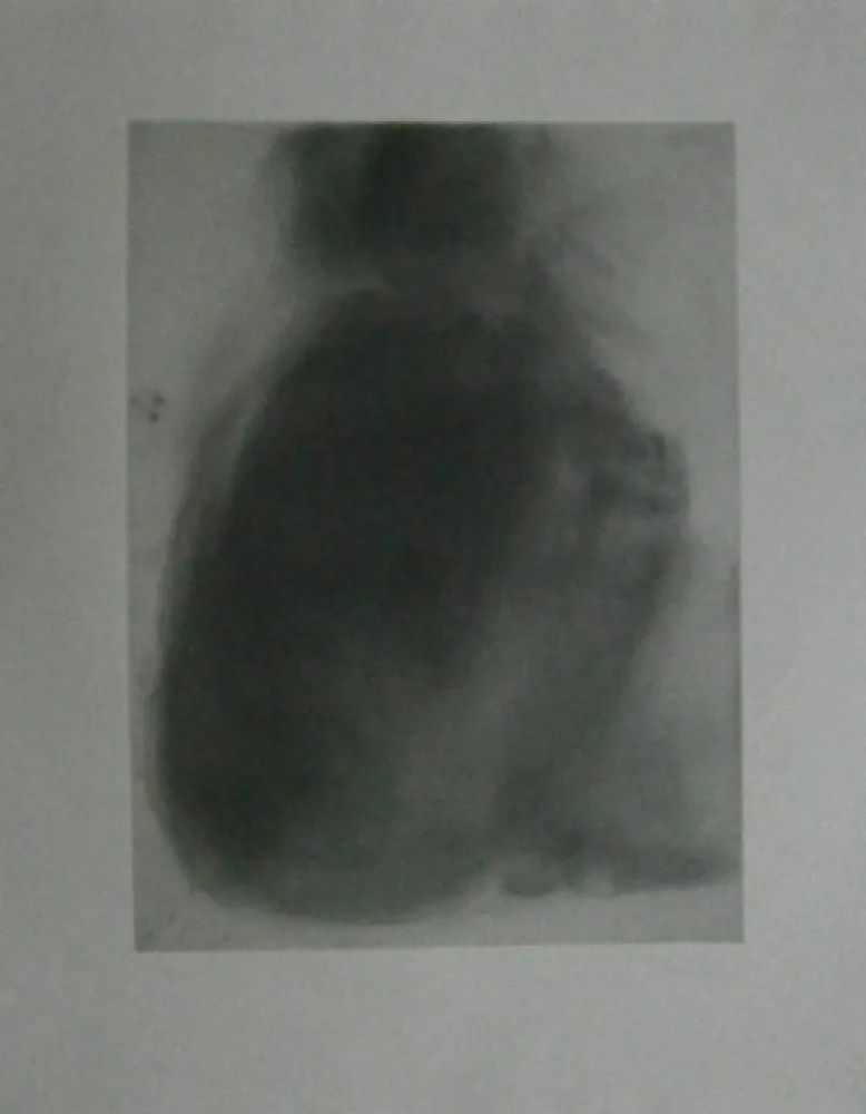 Aguafuerte Garache - Tourette