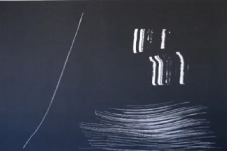 Litografía Hartung - Farandole 9