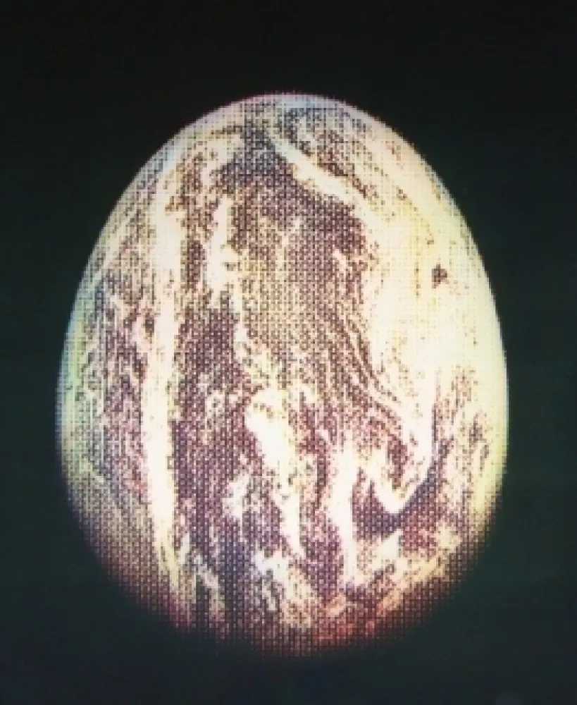 Aguafuerte Y Aguatinta Jacquet - L'oeuf