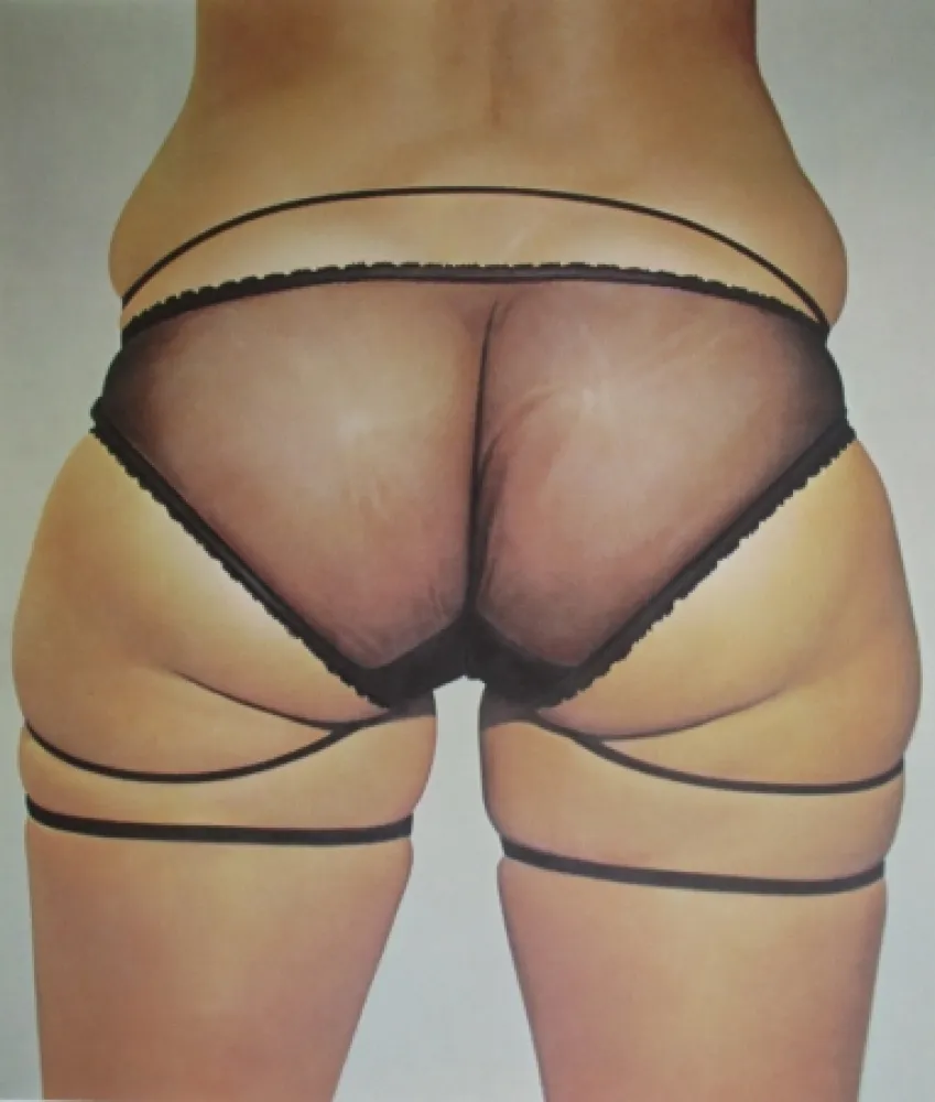 Litografía Kacere - Loretta 