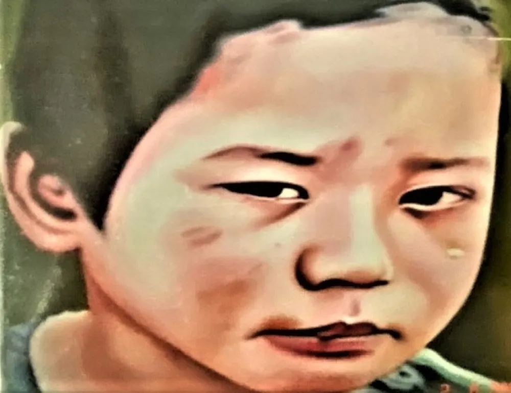 Múltiple Komu - Last Landscape 1