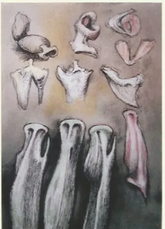 Litografía Moore - Tree sisters