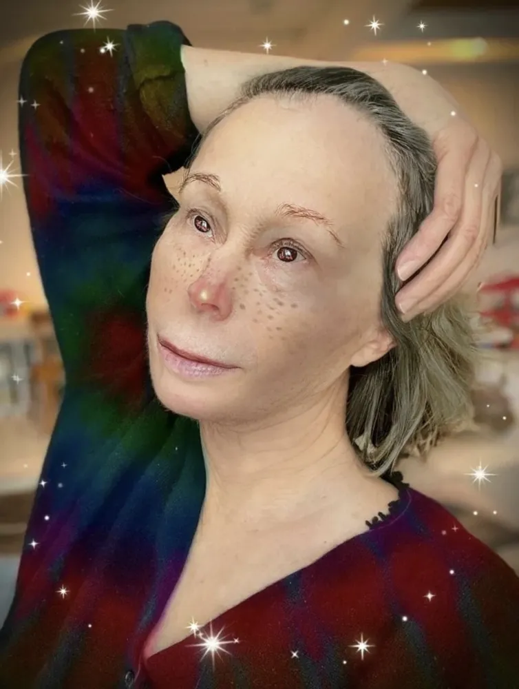 Múltiple Sherman - Untitled (Twinkle-Nose)